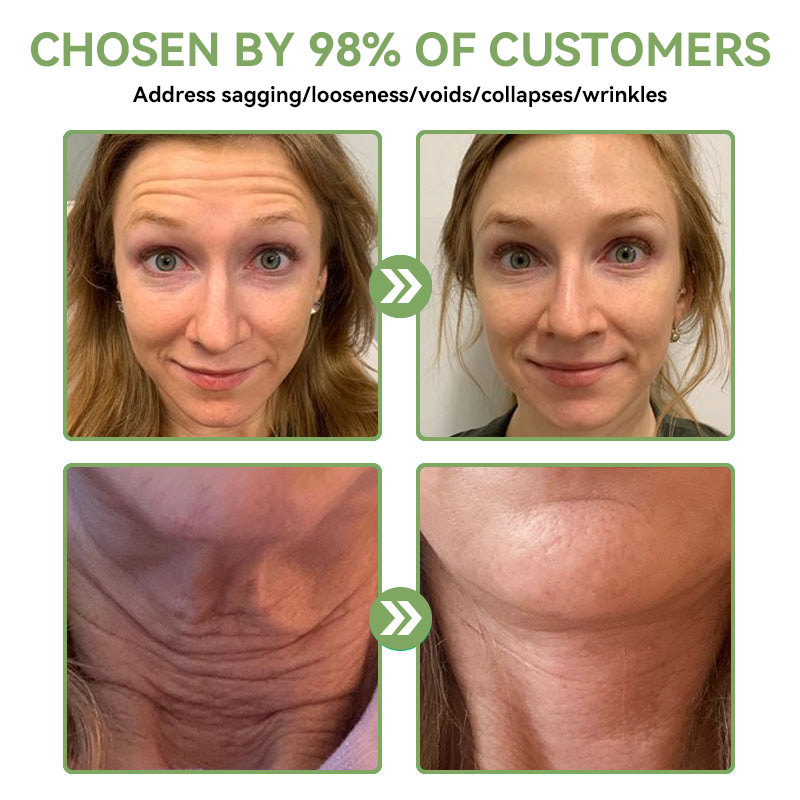 𝐒𝐓𝐃𝐄𝐈™ ✨ 𝐋𝐮𝐱𝐮𝐫𝐢𝐨𝐮𝐬 𝐂𝐨𝐥𝐥𝐚𝐠𝐞𝐧 𝐅𝐢𝐫𝐦𝐢𝐧𝐠 𝐂𝐫𝐞𝐚𝐦(🔥74% Off for a Limited Time!)🥑🥑