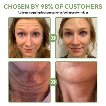 𝐒𝐓𝐃𝐄𝐈™ ✨ 𝐋𝐮𝐱𝐮𝐫𝐢𝐨𝐮𝐬 𝐂𝐨𝐥𝐥𝐚𝐠𝐞𝐧 𝐅𝐢𝐫𝐦𝐢𝐧𝐠 𝐂𝐫𝐞𝐚𝐦(🔥74% Off for a Limited Time!)🥑🥑