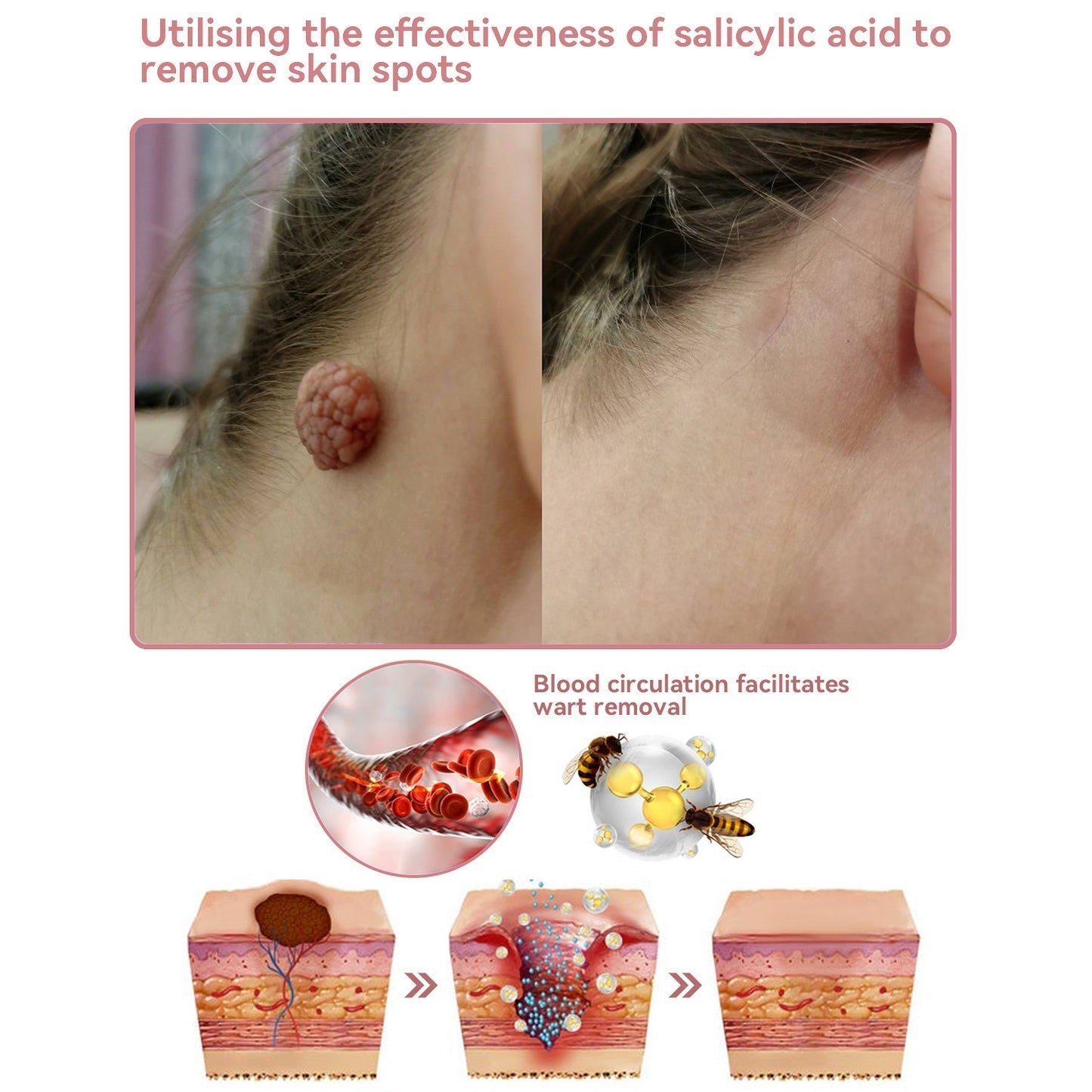Coenzyme Q10 Collagen Jelly Skin Cream - Christmas Sale, up to 80% off, USA News Products